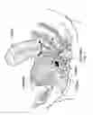Fig. 08 - Electronic pelvic organ prolapse quantification system