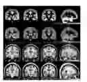 Fig. 01 - Automatic MRI Quantification of Structural Body Abnormalities