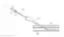 Fig. 01 - Catheter for left coronary artery and engaging method therefor
