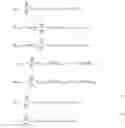 Fig. 08 - Method and apparatus for assessment of fluid responsiveness