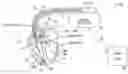 Fig. 01 - METHOD AND APPARATUS FOR DETECTING FIBRILLATION USING CARDIAC LOCAL IMPEDANCE