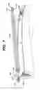 Fig. 08 - Biopsy device with variable speed cutter advance