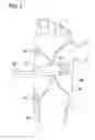 Fig. 02 - Reduced noise pneumatic compression garment