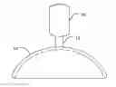 Fig. 01 - INTRAOCULAR IONTOPHORETIC DEVICE AND ASSOCIATED METHODS