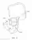 Fig. 06 - METHOD AND APPARATUS FOR MANAGING JOINT IRRIGATION DURING HIP ARTHROSCOPY