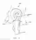 Fig. 08 - METHOD AND APPARATUS FOR MANAGING JOINT IRRIGATION DURING HIP ARTHROSCOPY