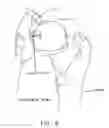 Fig. 09 - METHOD AND APPARATUS FOR MANAGING JOINT IRRIGATION DURING HIP ARTHROSCOPY