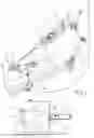 Fig. 02 - Interface for Actuating a Robotic Manipulator from a Remote Position for Manoeuvring Steerable Catheters in the Human Cardiovascular System