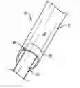 Fig. 01 - Vascular access to closure sheath and methods