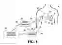 Fig. 02 - Methods for guiding heart failure decompensation therapy