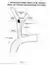 Fig. 02 - VASCULAR FILTER WITH IMPROVED STRENGTH AND FLEXIBILITY