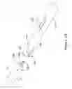 Fig. 07 - Delivery system having stent locking structure