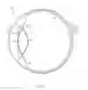 Fig. 02 - Methods for enhancing accommodation of a natural lens of an eye
