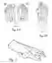 Fig. 02 - Methods and devices for treating a structural bone and joint deformity