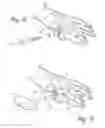 Fig. 05 - Methods and devices for treating a structural bone and joint deformity