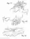 Fig. 07 - Methods and devices for treating a structural bone and joint deformity