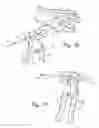 Fig. 09 - Methods and devices for treating a structural bone and joint deformity