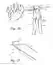 Fig. 10 - Methods and devices for treating a structural bone and joint deformity
