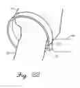 Fig. 11 - Methods and devices for treating a structural bone and joint deformity
