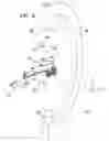 Fig. 07 - DRILL-AIMING METHOD AND APPARATUS