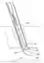 Fig. 01 - Foldable, implantable electrode assembly