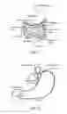 Fig. 02 - Devices and methods for treatment of gastrointestinal disorders