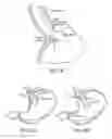 Fig. 04 - Devices and methods for treatment of gastrointestinal disorders