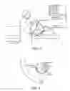 Fig. 06 - Devices and methods for treatment of gastrointestinal disorders