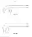 Fig. 13 - Devices and methods for treatment of gastrointestinal disorders
