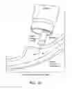 Fig. 17 - Devices and methods for treatment of gastrointestinal disorders
