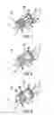 Fig. 02 - LIGATING BAND DISPENSER DEVICE