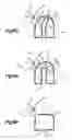 Fig. 13 - Suture based tissue repair
