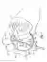 Fig. 04 - Devices For Installing Stasis Reducing Means In Body Tissue
