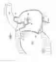 Fig. 07 - Devices For Installing Stasis Reducing Means In Body Tissue