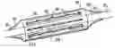 Fig. 01 - Stiffened balloon apparatus with increased flexibility