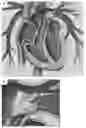 Fig. 01 - LARGE MOUTH SNARE DEVICE