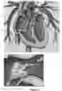 Fig. 07 - LARGE MOUTH SNARE DEVICE