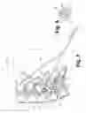 Fig. 04 - Systems and methods for minimally invasive facet fusion