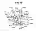 Fig. 08 - Methods and devices for manipulating a vertebra