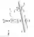 Fig. 09 - Methods and devices for manipulating a vertebra