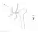 Fig. 02 - Surgical positioners