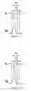 Fig. 10 - Method and circuitry for measurement of stimulation current