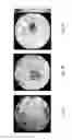 Fig. 07 - Means and Methods for Influencing Electrical Activity of Cells