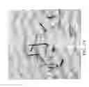 Fig. 05 - Method and appartus for extraction of plant embryos