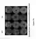 Fig. 17 - METHODS AND COMPOSITIONS FOR TRANSGENIC PLANTS PRODUCING ANTIMICROBIAL PEPTIDES FOR ENHANCED DISEASE RESISTANCE