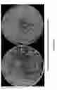 Fig. 18 - METHODS AND COMPOSITIONS FOR TRANSGENIC PLANTS PRODUCING ANTIMICROBIAL PEPTIDES FOR ENHANCED DISEASE RESISTANCE
