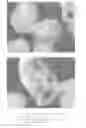 Fig. 04 - Plant transformation method