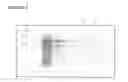 Fig. 07 - MULTI EPITOPE VACCINE FOR POULTRY