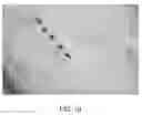 Fig. 05 - Treatment of Folded Articles