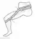 Fig. 01 - Pelvic and lumbar spine support